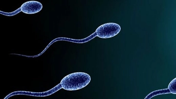 Spermde Lökosit Fazlalığı